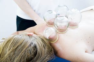 woman on a massage table getting a cupping massage